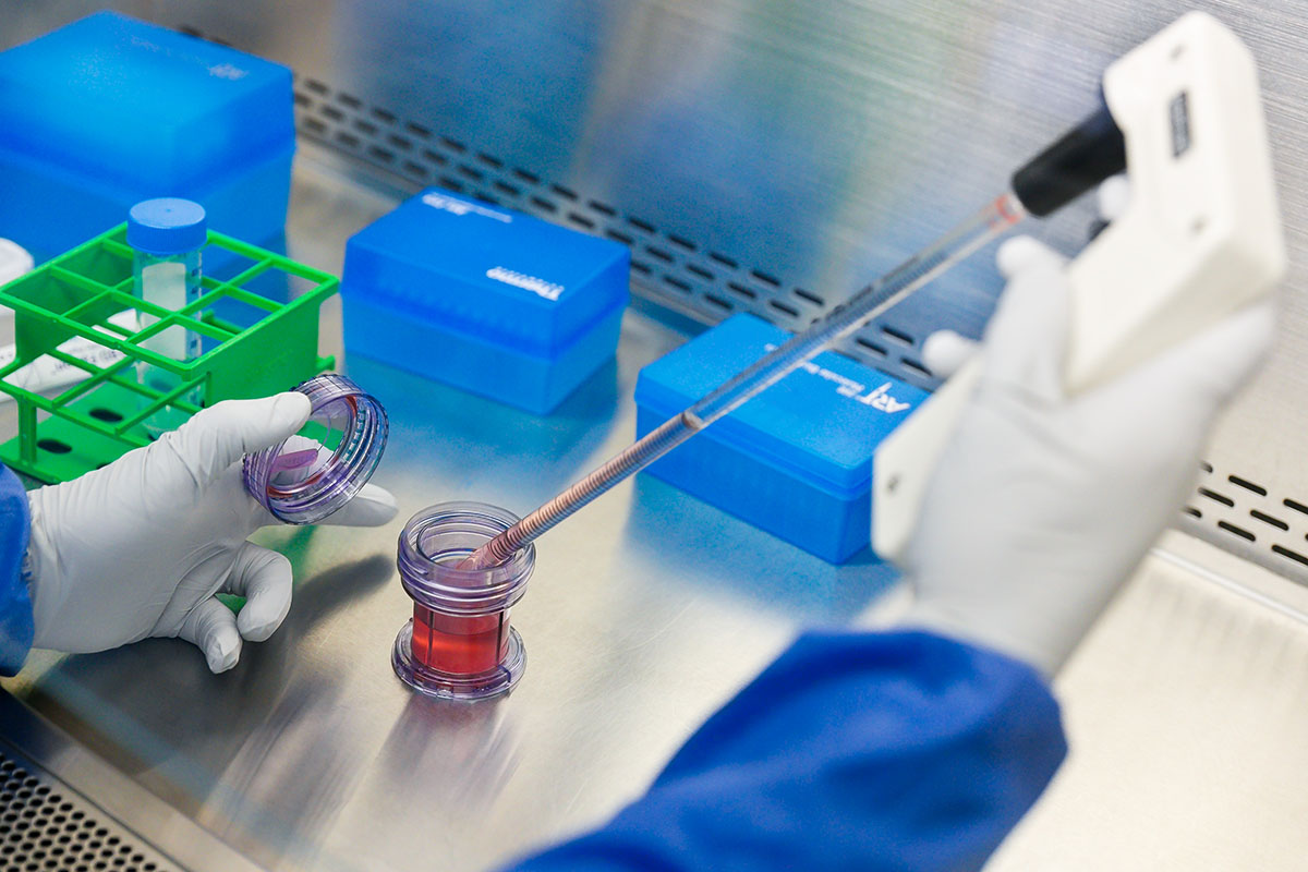 Biogem scopre nuovo biomarcatore del cancro gastrico